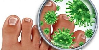 How to treat a fungal infection on your fingers