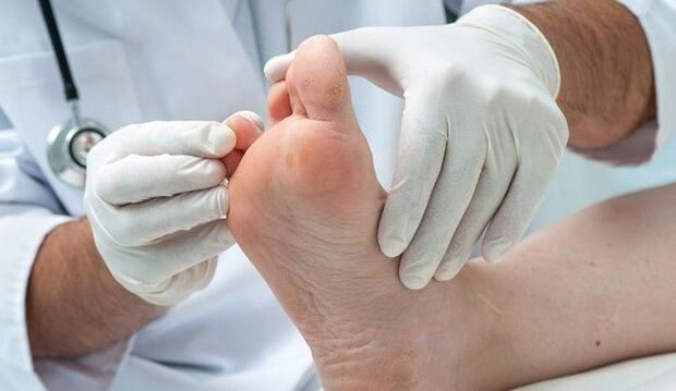 fungus treatment and diagnosis by a doctor